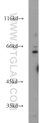 FOXP1 Antibody in Western Blot (WB)