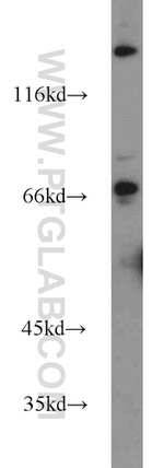 FOXP1 Antibody in Western Blot (WB)