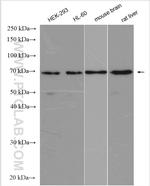 PPAR Gamma Antibody in Western Blot (WB)