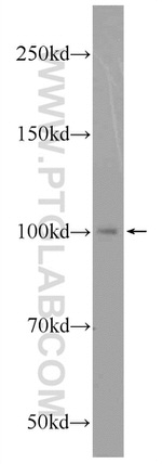 PDE6B Antibody in Western Blot (WB)