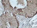 LTBP1 Antibody in Immunohistochemistry (Paraffin) (IHC (P))