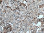 LTBP1 Antibody in Immunohistochemistry (Paraffin) (IHC (P))