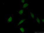 CDK8 Antibody in Immunocytochemistry (ICC/IF)