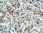 CDK8 Antibody in Immunohistochemistry (Paraffin) (IHC (P))