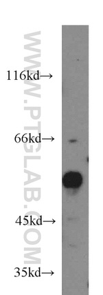 CDK8 Antibody in Western Blot (WB)