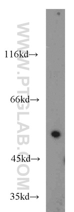 CDK8 Antibody in Western Blot (WB)