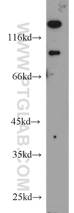 UNC5A Antibody in Western Blot (WB)