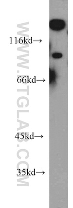 UNC5A Antibody in Western Blot (WB)