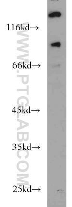 UNC5A Antibody in Western Blot (WB)