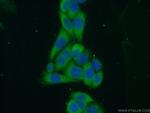 IMPDH1 Antibody in Immunocytochemistry (ICC/IF)