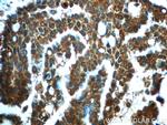 IMPDH1 Antibody in Immunohistochemistry (Paraffin) (IHC (P))