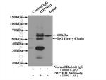 IMPDH1 Antibody in Immunoprecipitation (IP)