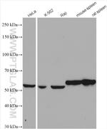 IMPDH1 Antibody in Western Blot (WB)