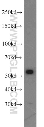 IMPDH1 Antibody in Western Blot (WB)