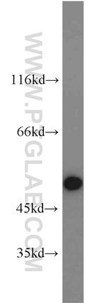 RBM22 Antibody in Western Blot (WB)