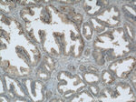 GSK3B Antibody in Immunohistochemistry (Paraffin) (IHC (P))