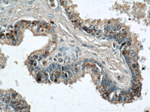 GSK3B Antibody in Immunohistochemistry (Paraffin) (IHC (P))