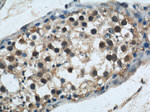 GSK3B Antibody in Immunohistochemistry (Paraffin) (IHC (P))