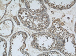 GSK3B Antibody in Immunohistochemistry (Paraffin) (IHC (P))