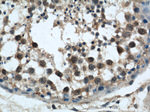 GSK3B Antibody in Immunohistochemistry (Paraffin) (IHC (P))