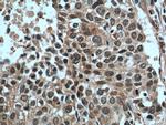 GSK3B Antibody in Immunohistochemistry (Paraffin) (IHC (P))