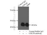 GSK3B Antibody in Immunoprecipitation (IP)