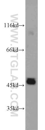 GSK3B Antibody in Western Blot (WB)