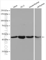 GSK3B Antibody in Western Blot (WB)