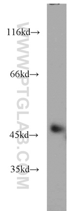 GSK3B Antibody in Western Blot (WB)