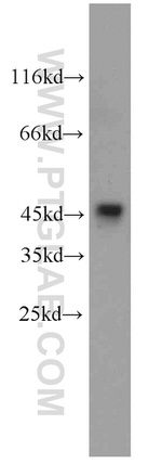 GSK3B Antibody in Western Blot (WB)