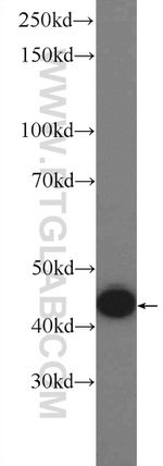 GSK3B Antibody in Western Blot (WB)