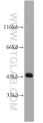 GSK3B Antibody in Western Blot (WB)