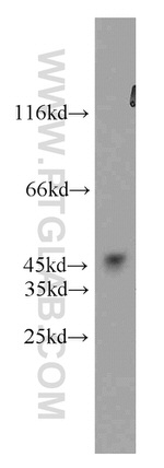 GSK3B Antibody in Western Blot (WB)