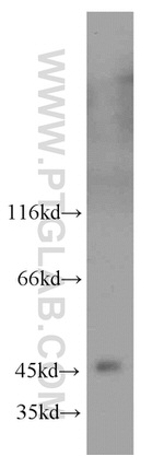 GSK3B Antibody in Western Blot (WB)