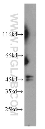 GSK3B Antibody in Western Blot (WB)