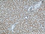 ALDH1A1 Antibody in Immunohistochemistry (Paraffin) (IHC (P))