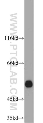 ALDH1A1 Antibody in Western Blot (WB)