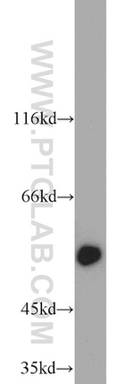 ALDH1A1 Antibody in Western Blot (WB)