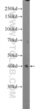 AP1/JUN/P39 Antibody in Western Blot (WB)