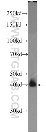 AP1/JUN/P39 Antibody in Western Blot (WB)