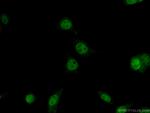 AP1/JUN/P39 Antibody in Immunocytochemistry (ICC/IF)