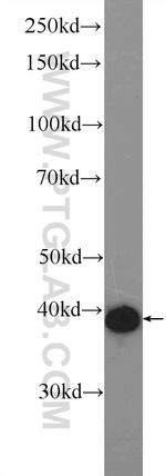 AP1/JUN/P39 Antibody in Western Blot (WB)