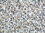 MYPT1 Antibody in Immunohistochemistry (Paraffin) (IHC (P))