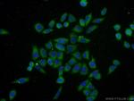 Ubiquilin 1 Antibody in Immunocytochemistry (ICC/IF)