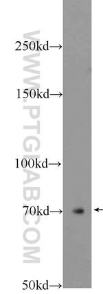 Ubiquilin 1 Antibody in Western Blot (WB)