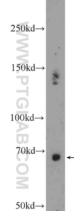 Ubiquilin 1 Antibody in Western Blot (WB)