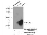 TNNI2 Antibody in Immunoprecipitation (IP)