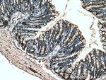 TIGAR Antibody in Immunohistochemistry (Paraffin) (IHC (P))