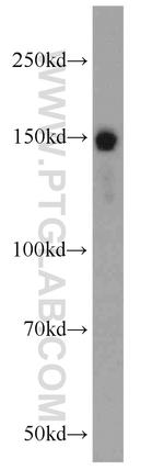 RASAL2 Antibody in Western Blot (WB)