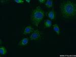 FUT4 Antibody in Immunocytochemistry (ICC/IF)